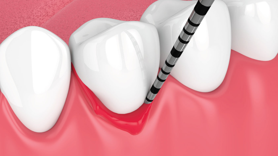 Periodontics