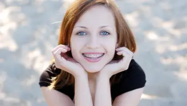 Braces