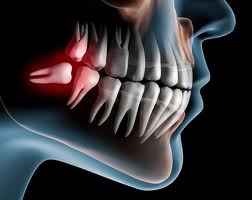 Oral Surgery