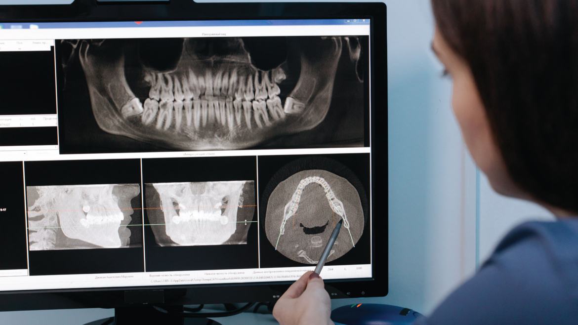 CBCT Scans