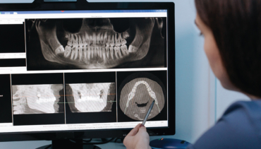 CBCT Scans